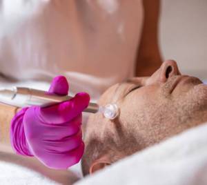 Nahaufnahme einer Kosmetikerin mit pinken Handschuhen, die einem Mann eine Dermatude Meta Therapy im Gesicht durchführt.